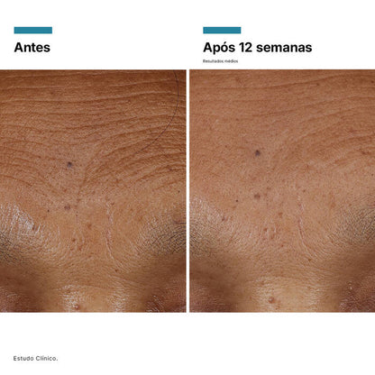 HA Intensifier Multi-Glycan Sérum Preenchedor 30ml – SkinCeuticals