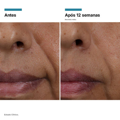 HA Intensifier Multi-Glycan Sérum Preenchedor 30ml – SkinCeuticals